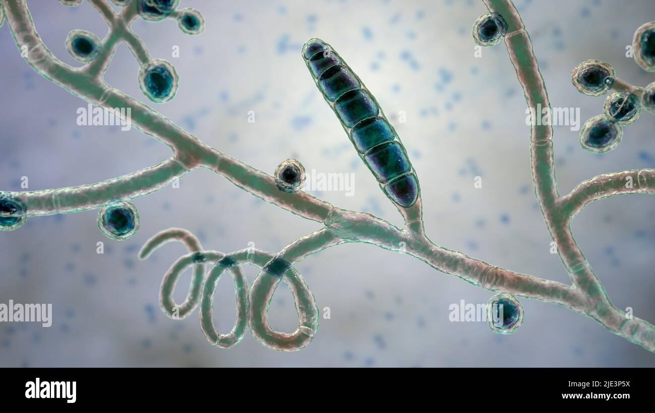 Fungi Trichophyton mentagrophytes, the cause of athlete's foot (tinea pedis), scalp ringworm (tinea capitus), and nail infection (onychomycosis), illu Stock Photo