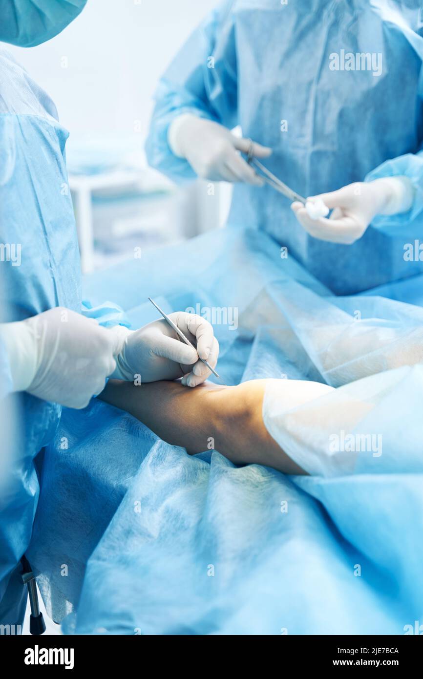 Surgical Operation Of Lower Limb Conducted By Professional Doctor Stock ...