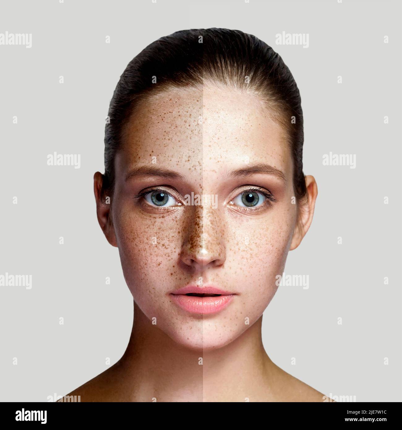 Closeup before, after portrait of beautiful woman after laser treatment removing freckles or pigment on face looking at camera. makeup or cosmetology. indoor studio shot, isolated on gray background. Stock Photo