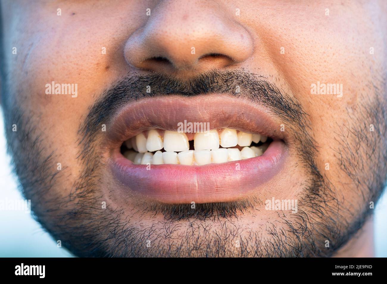 Detailed image of man showing his teeth. Dental health care. Hygiene teeth. Dentistry Stock Photo