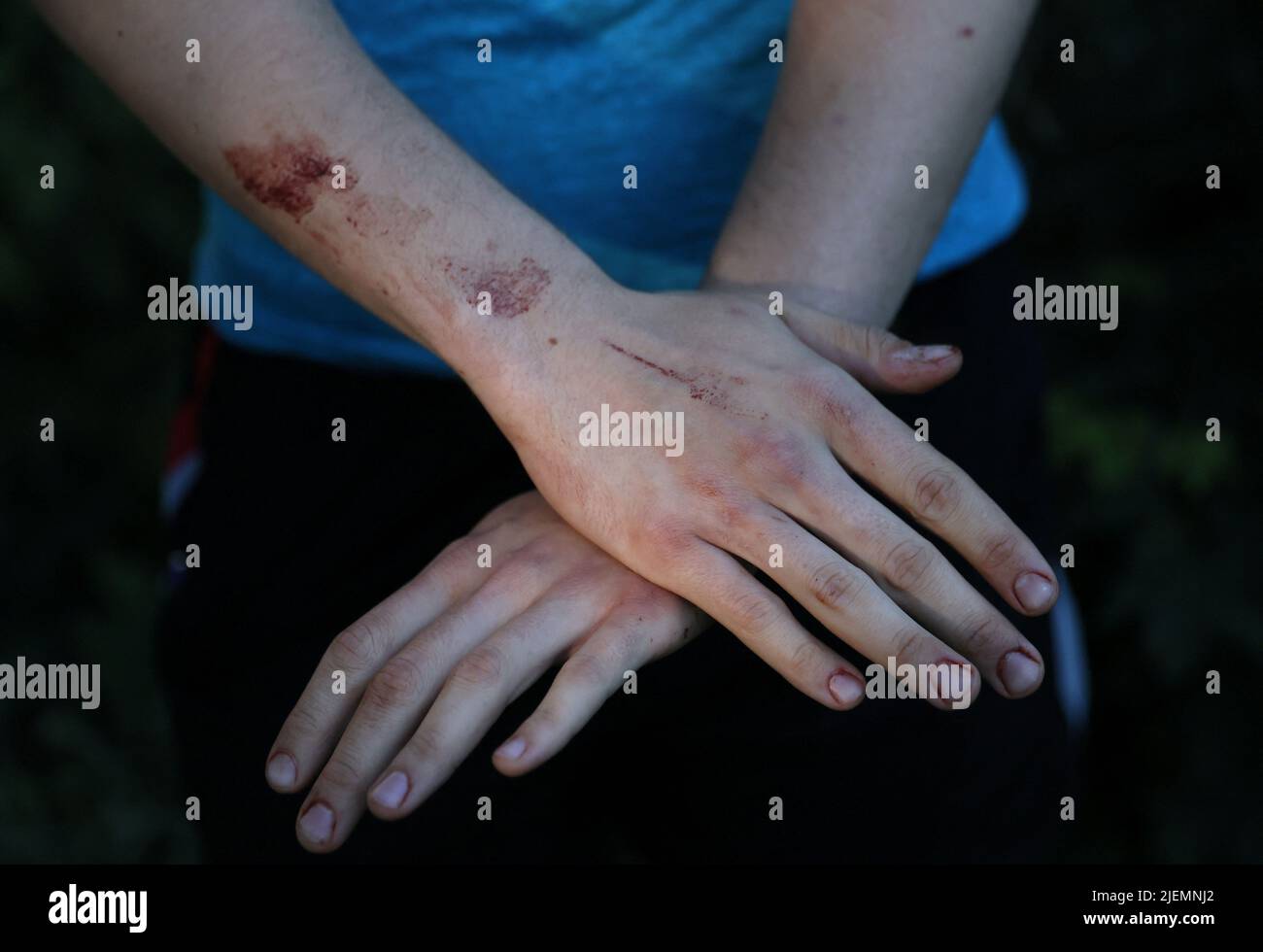 Maxim Antonenko, 20, shows leftover blood on his hands from when he