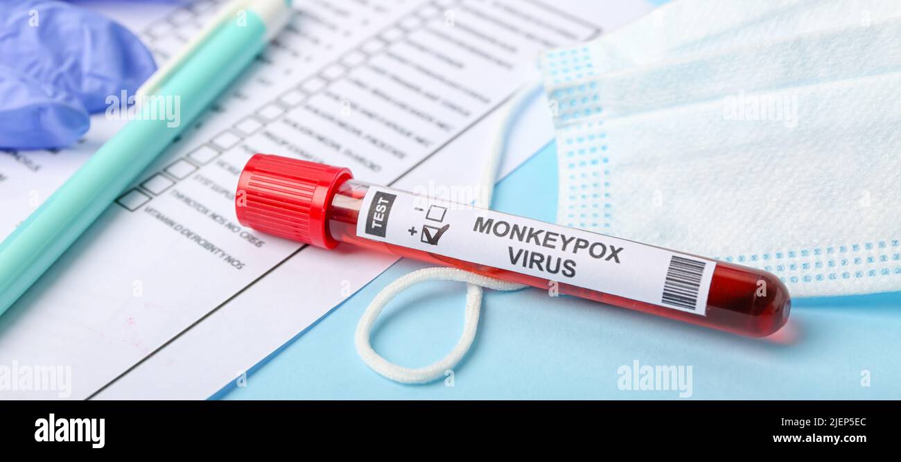 Test tube with sample of monkeypox virus and medical mask on table ...