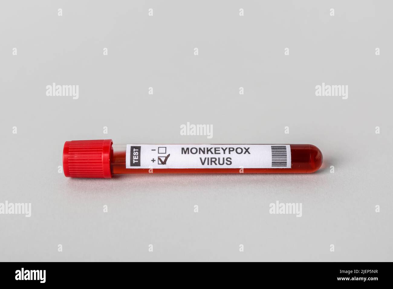 Test tube with blood sample on grey background. Monkeypox virus concept ...