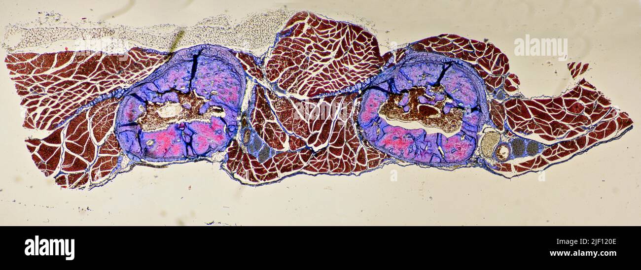 Human bone marrow hi-res stock photography and images - Alamy