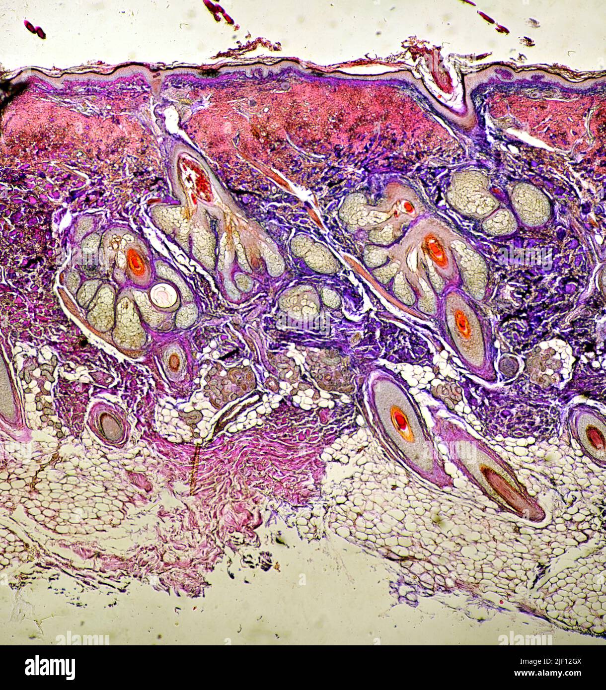 Cross section of the skin from human head with 'hair sacs' (papilla of hair), sweat glands and other structures are clearly visible. Stock Photo