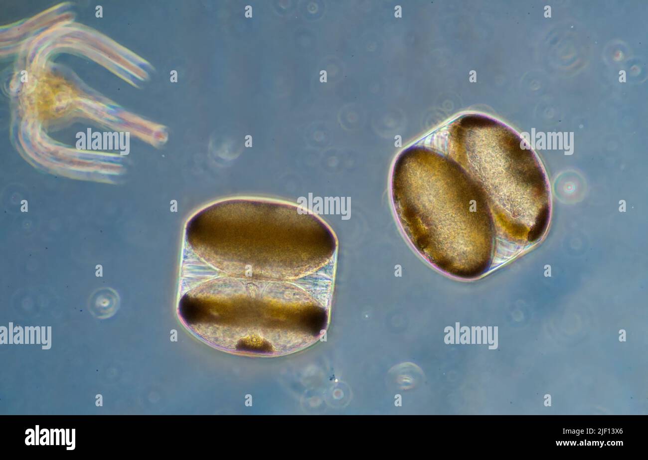Diatoms from the genus Coscinodiscus. South-western Norway, May 2011. The algae are about 0,006mm across. Stock Photo