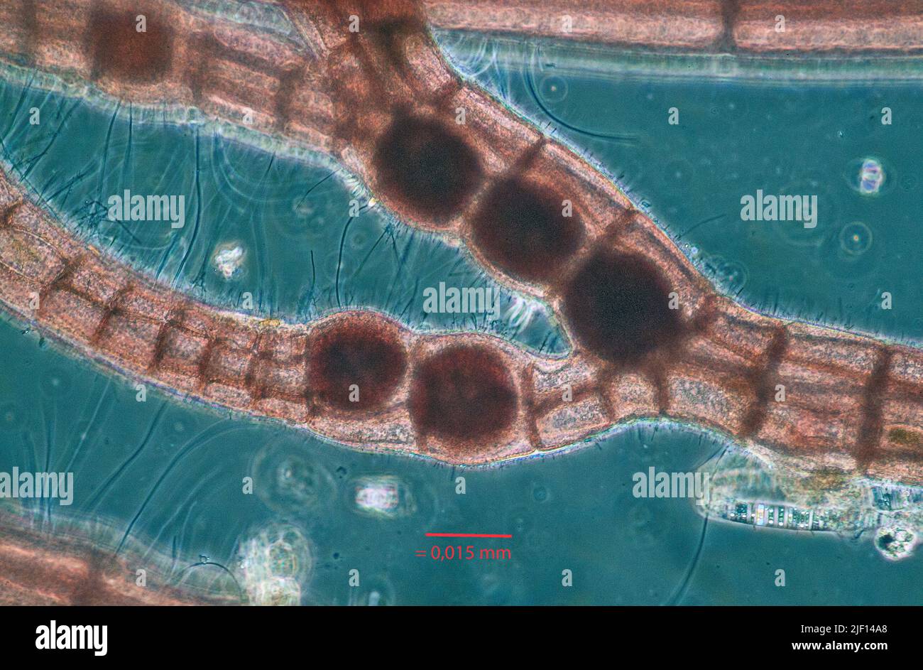 Tetrasporangia forming in the cells of the sporophyte of Polysiphonia sp. Stock Photo