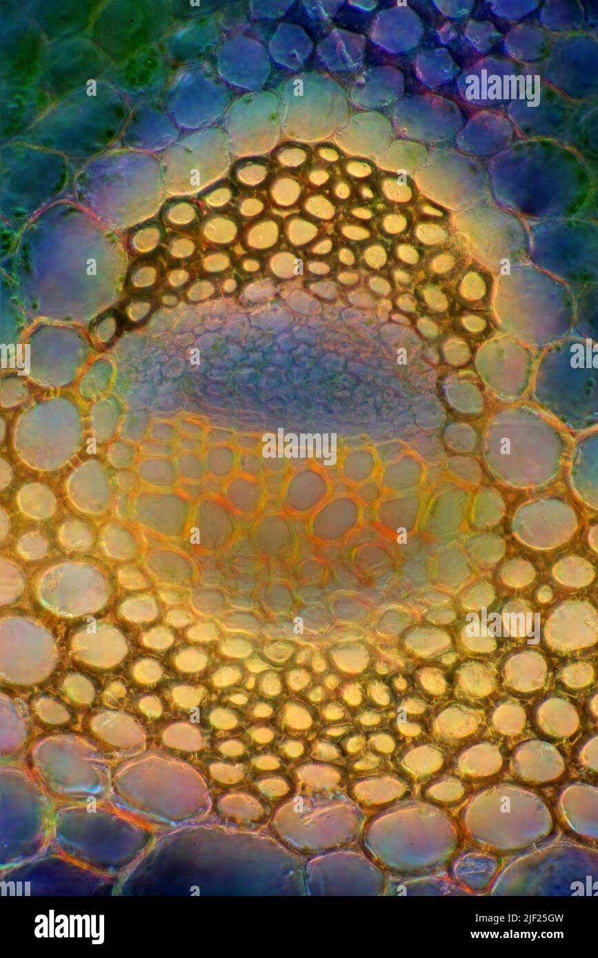 Polarised darkfield light micrograph of a transverse section through a