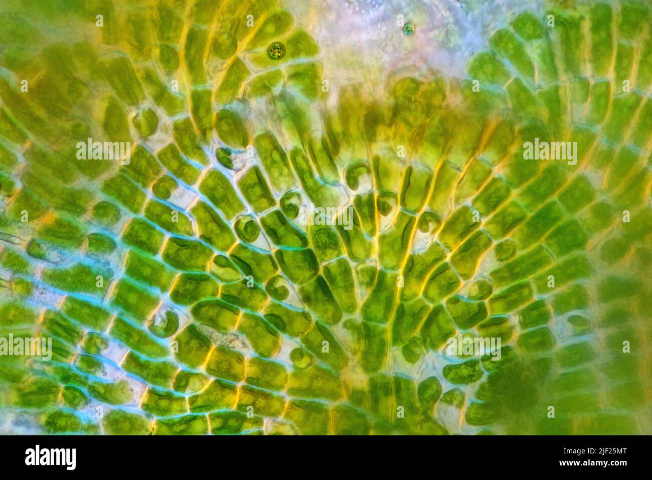 Polarized light micrograph of Phycopeltis green alga. Magnification