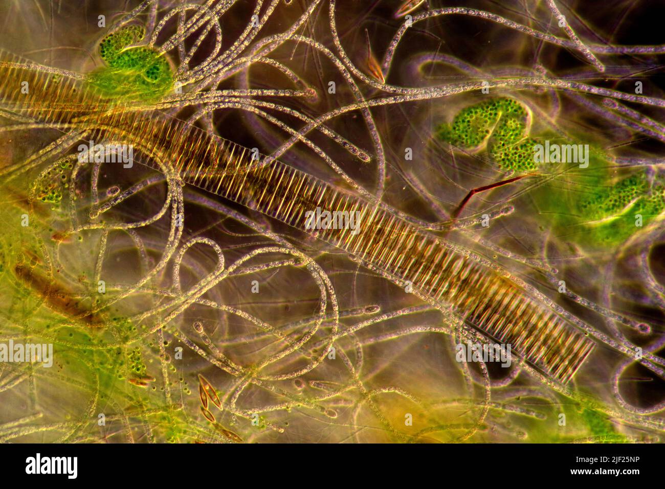 Dark field light micrograph of diatoms, ciliates and