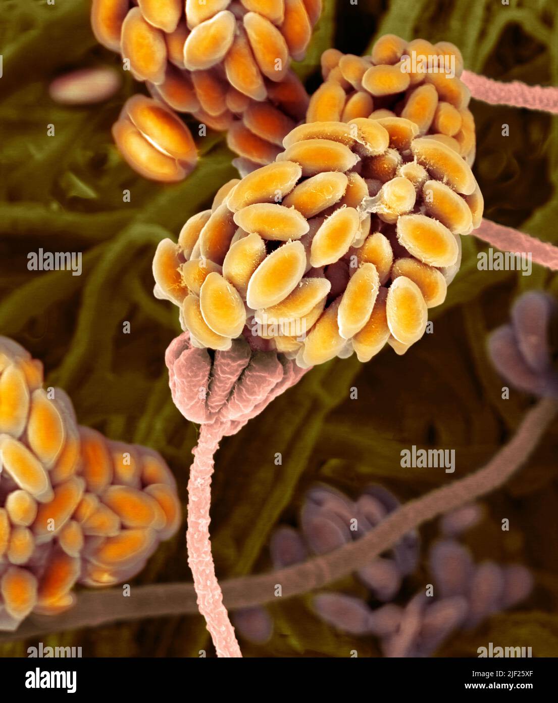 Stachybotrys Musae Toxic mould fungus (Stachybotrys chartarum), coloured scanning electron ...