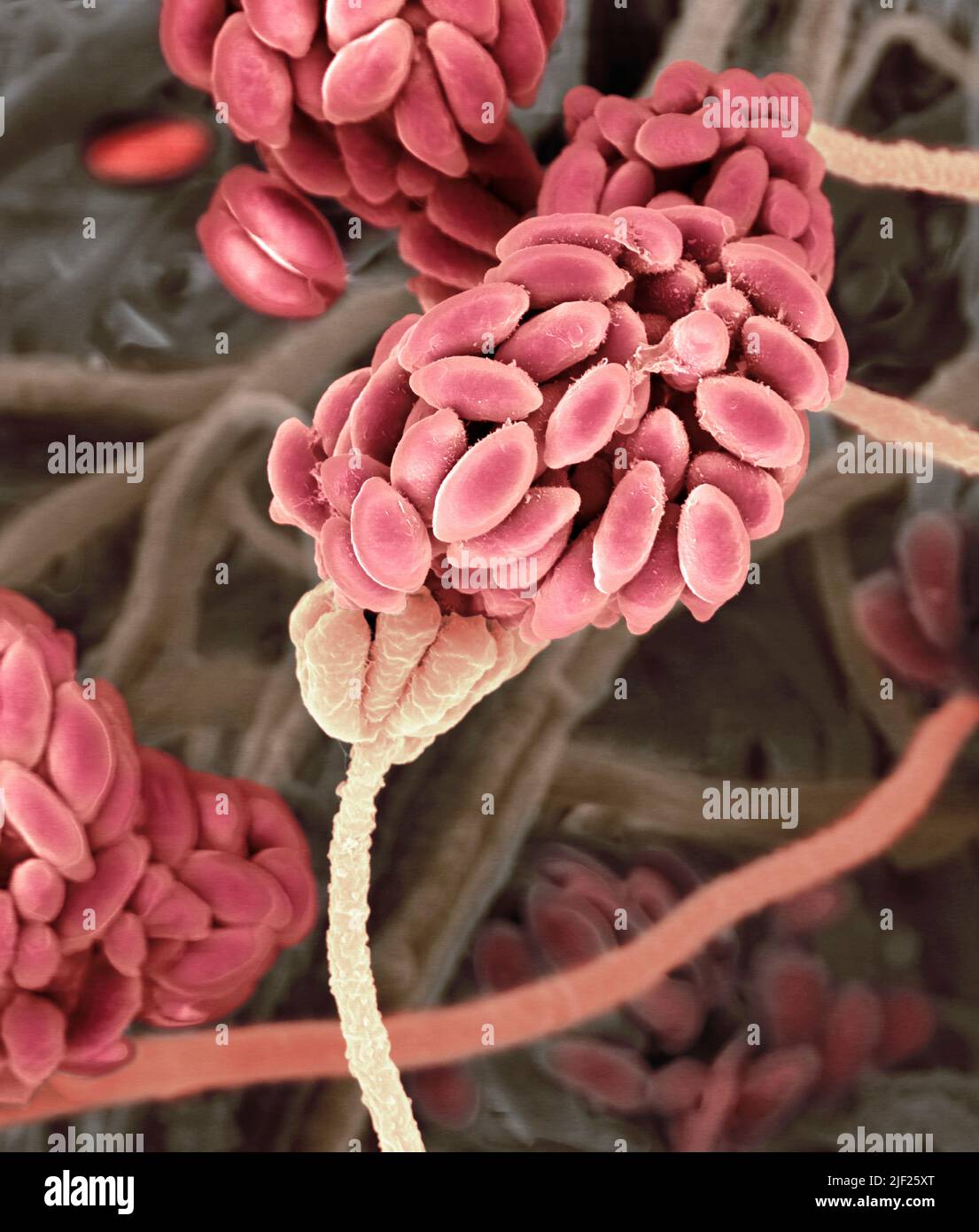 Toxic mould fungus (Stachybotrys chartarum), coloured scanning electron micrograph (SEM). Fruiting structures with spores. Often known as black mould. Stock Photo