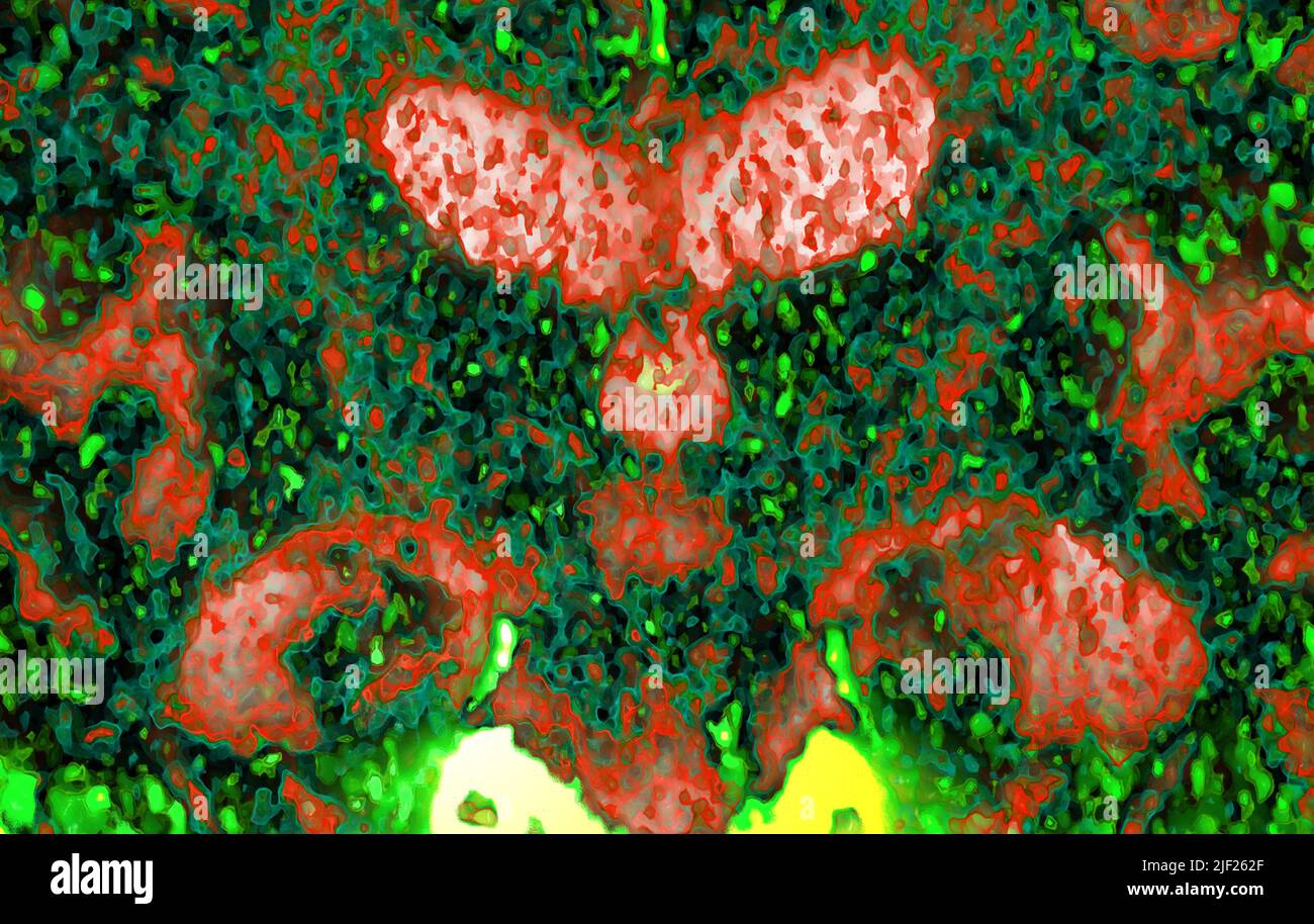 coloured-computed-tomography-ct-scan-of-a-coronal-section-through-the