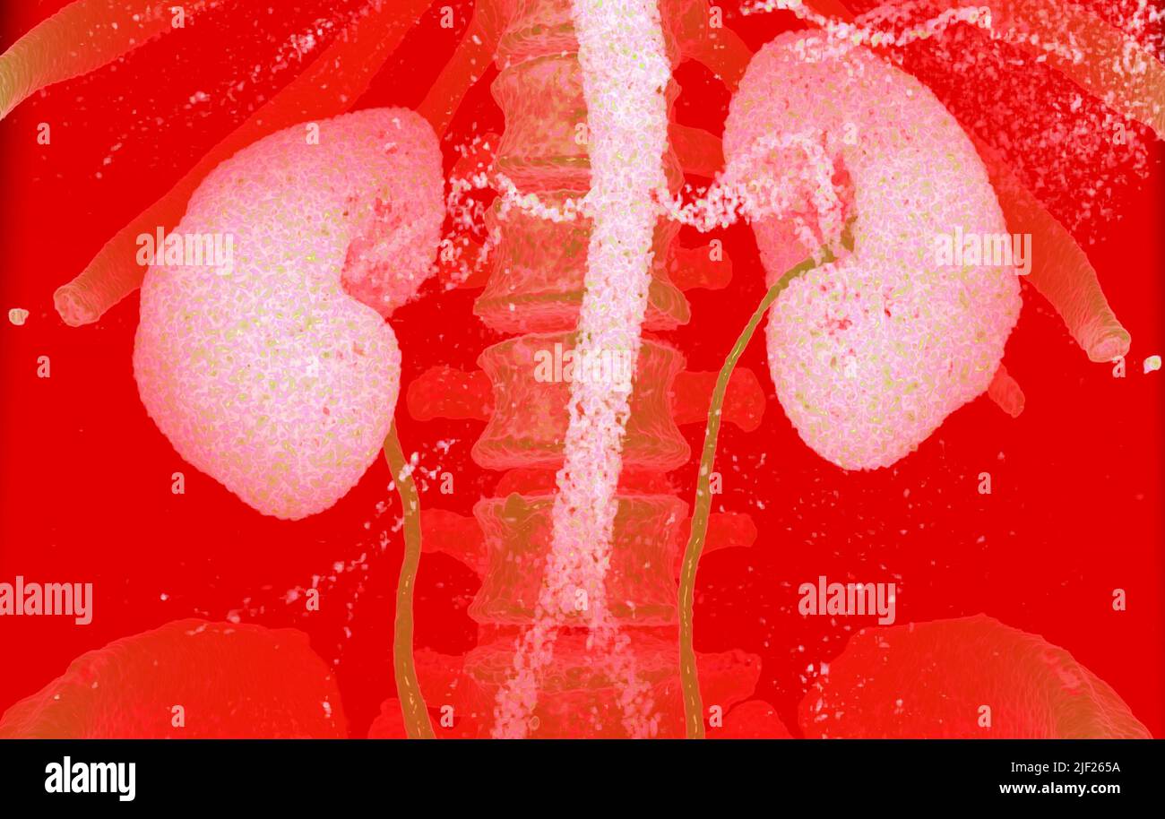 Coloured computed tomography (CT) scan of healthy human kidneys (pink