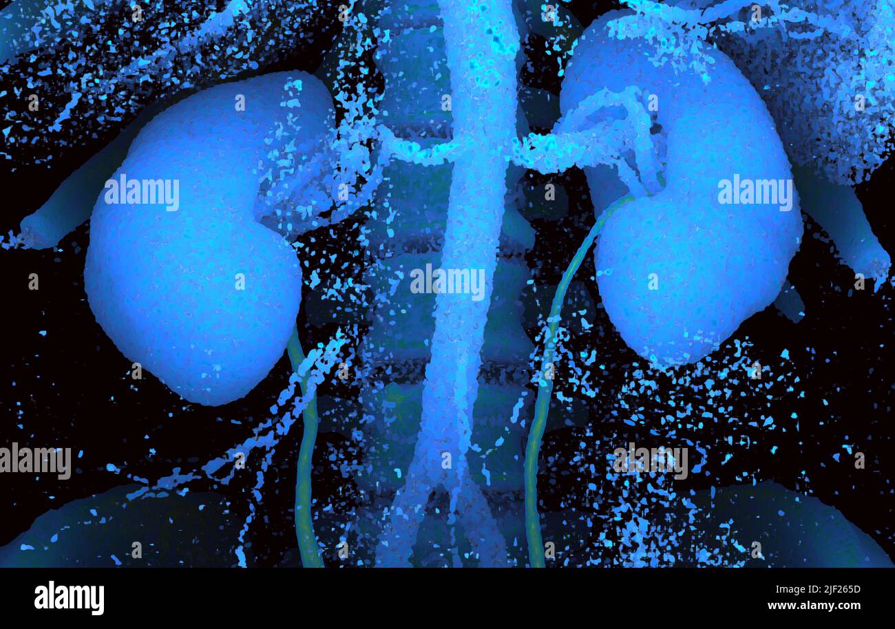 Coloured computed tomography (CT) scan of healthy human kidneys (blue