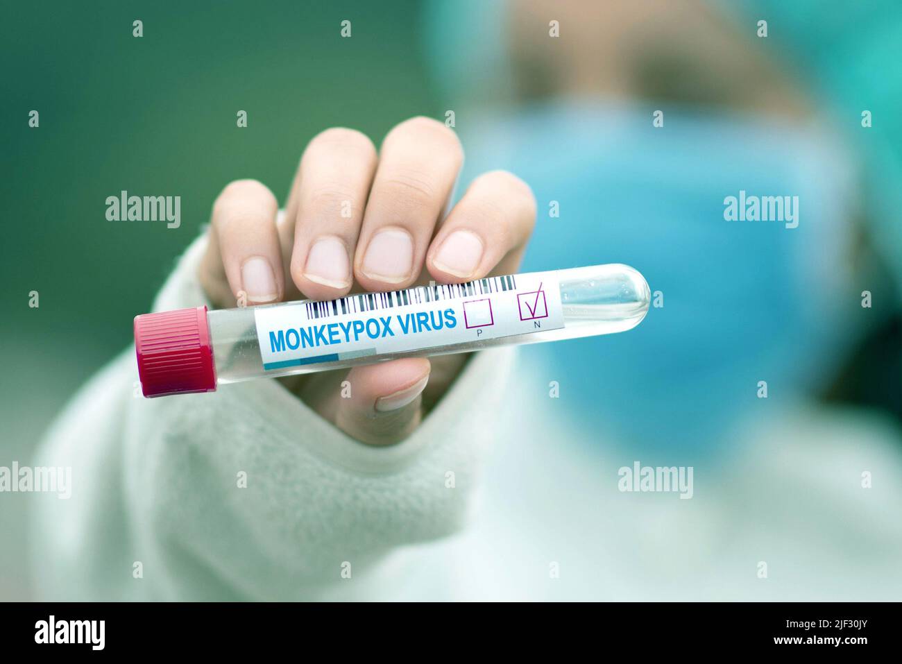 Nurse showing a test tube with monkeypox virus label Stock Photo
