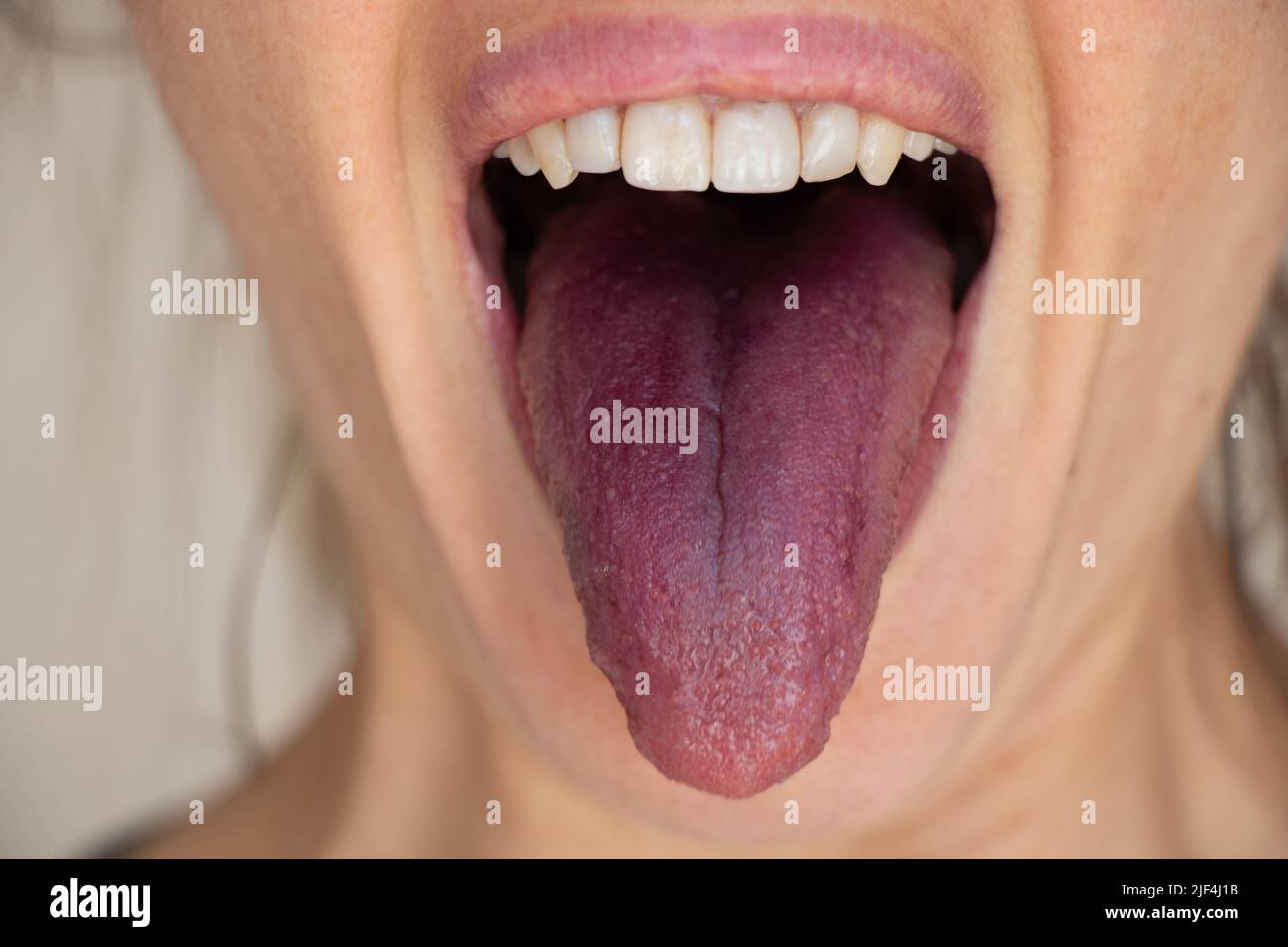 Red tongue after mulberry, open mouth and tongue of a girl close-up Stock Photo