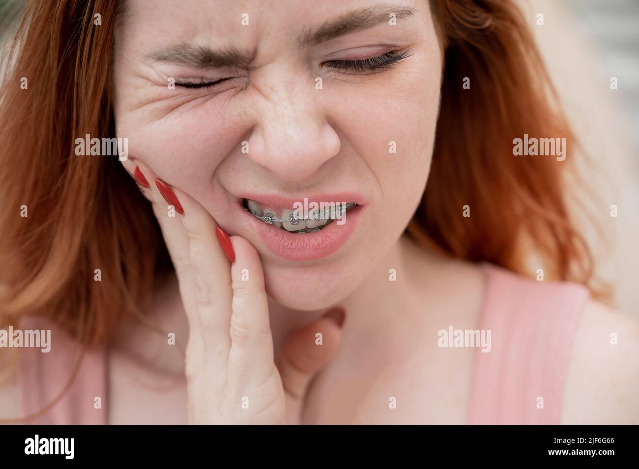 Young redhaired woman with braces suffering from pain Stock Photo Alamy