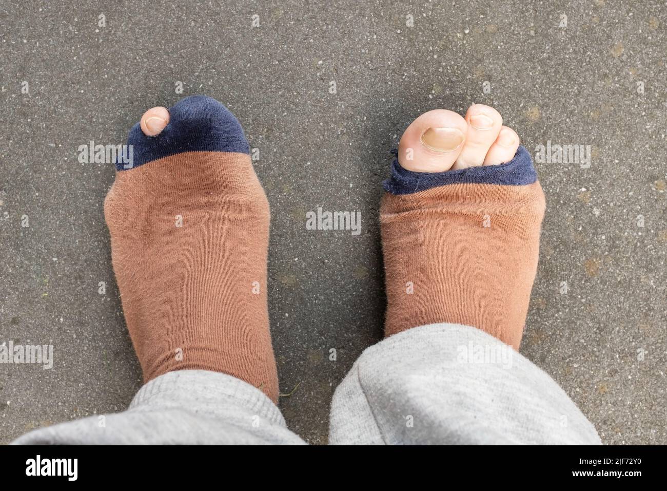 Male legs with protruding toes in holey worn socks, on a gray