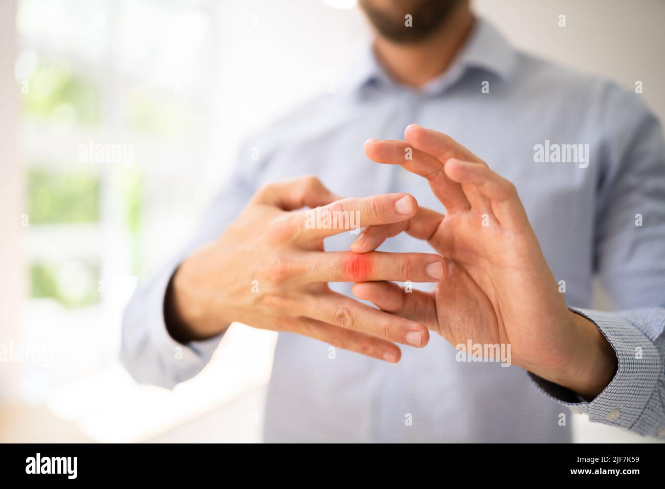 Finger Joint Arthritis. Hand Rheumatism Ache. Bone Fracture Stock Photo