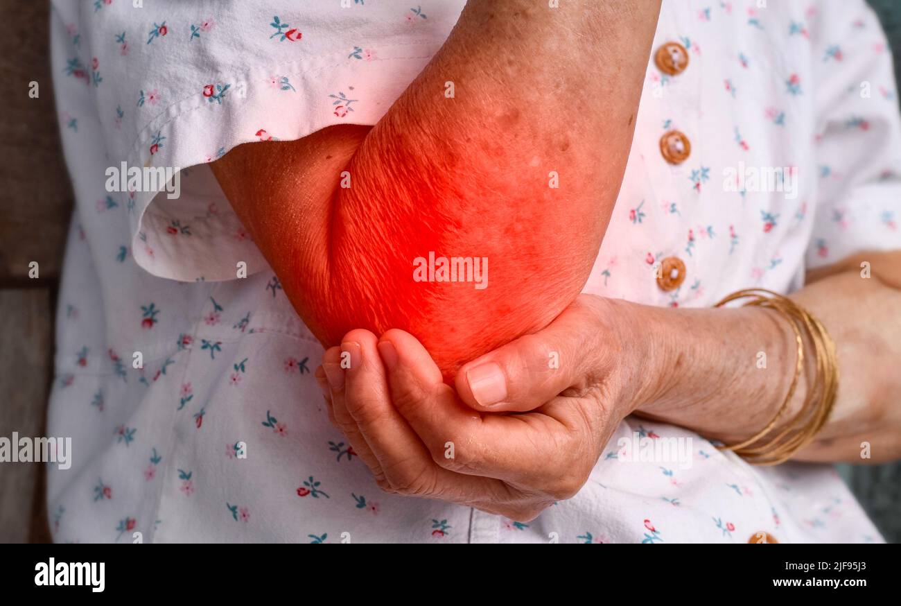 Pain in the elbow joint of Southeast Asian elder woman. Concept of