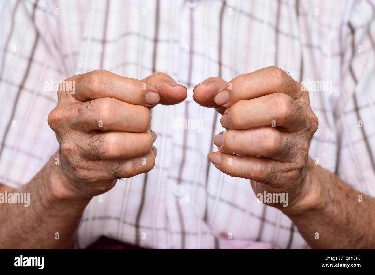 Hands of Southeast Asian elder man. Concept of rheumatoid arthritis