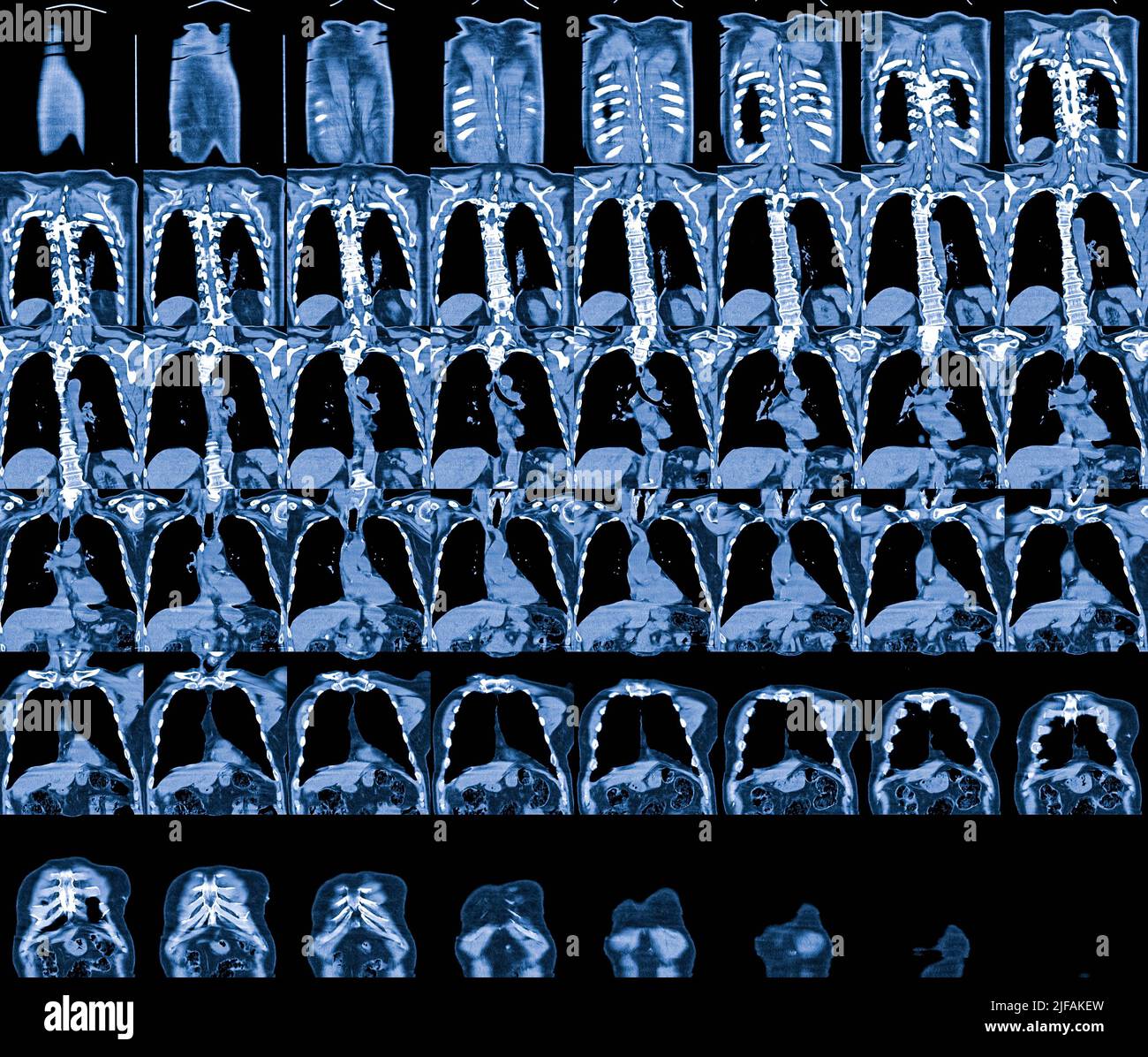 Resonance Image (MRI) of chest organs Stock Photo Alamy