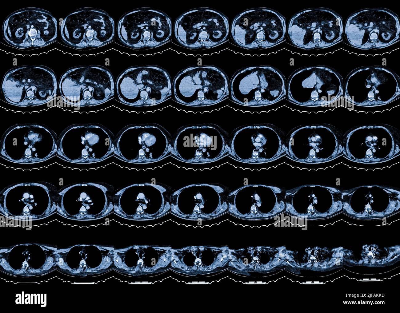Resonance Image (MRI) of chest organs Stock Photo Alamy