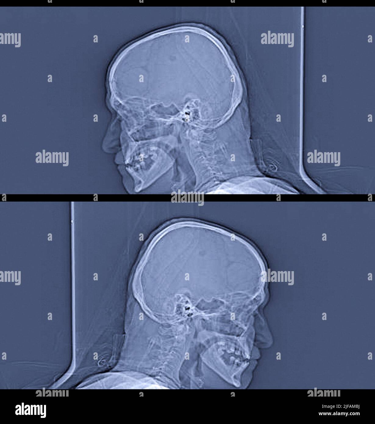 Human head on CT scan. Medical, science and education mri brain background. Magnetic resonance imaging Stock Photo