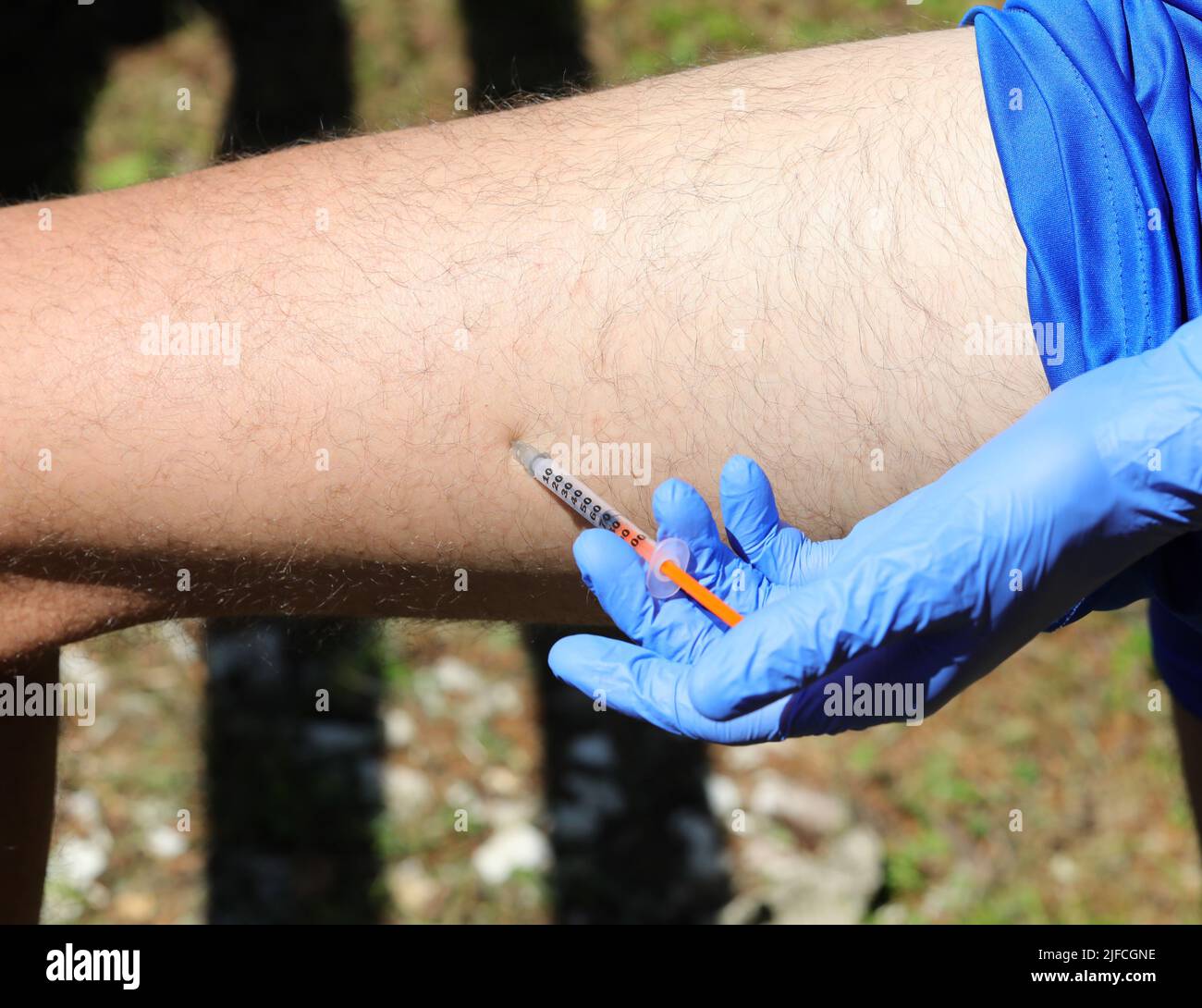 young boy with blue gloves while injecting insulin dose on the thigh of