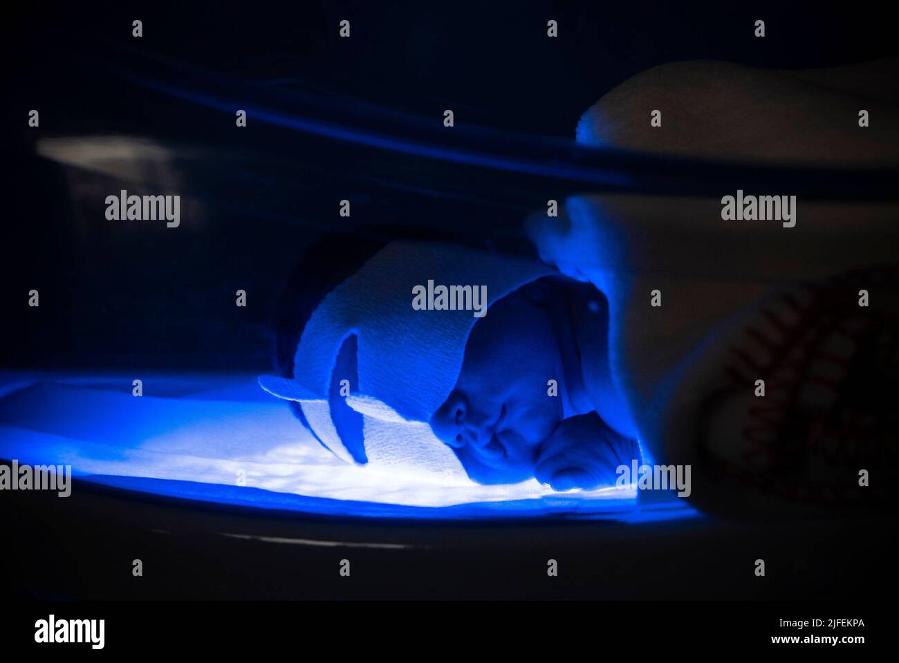 Newborn baby lying on LED phototherapy light bed to treat jaundice Stock Photo