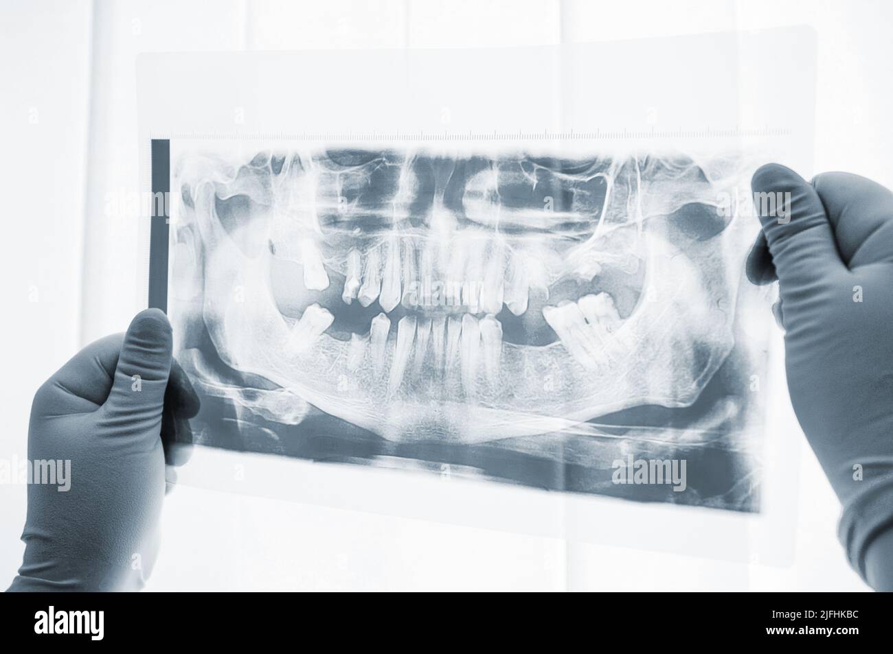 Dental surgery preparation xray scan closeup Stock Photo Alamy