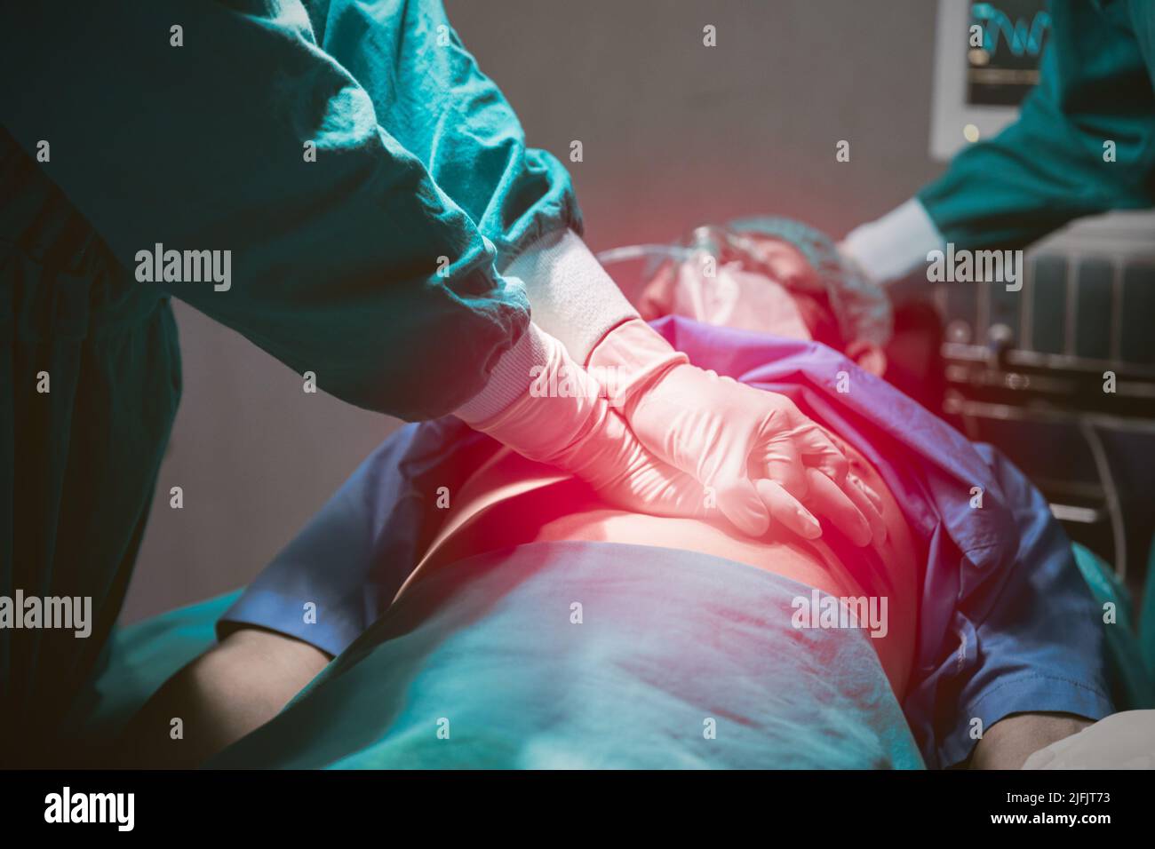 Medical team saving people life in hospital. Doctor first aid emergency CPR patient heart failure. Stock Photo
