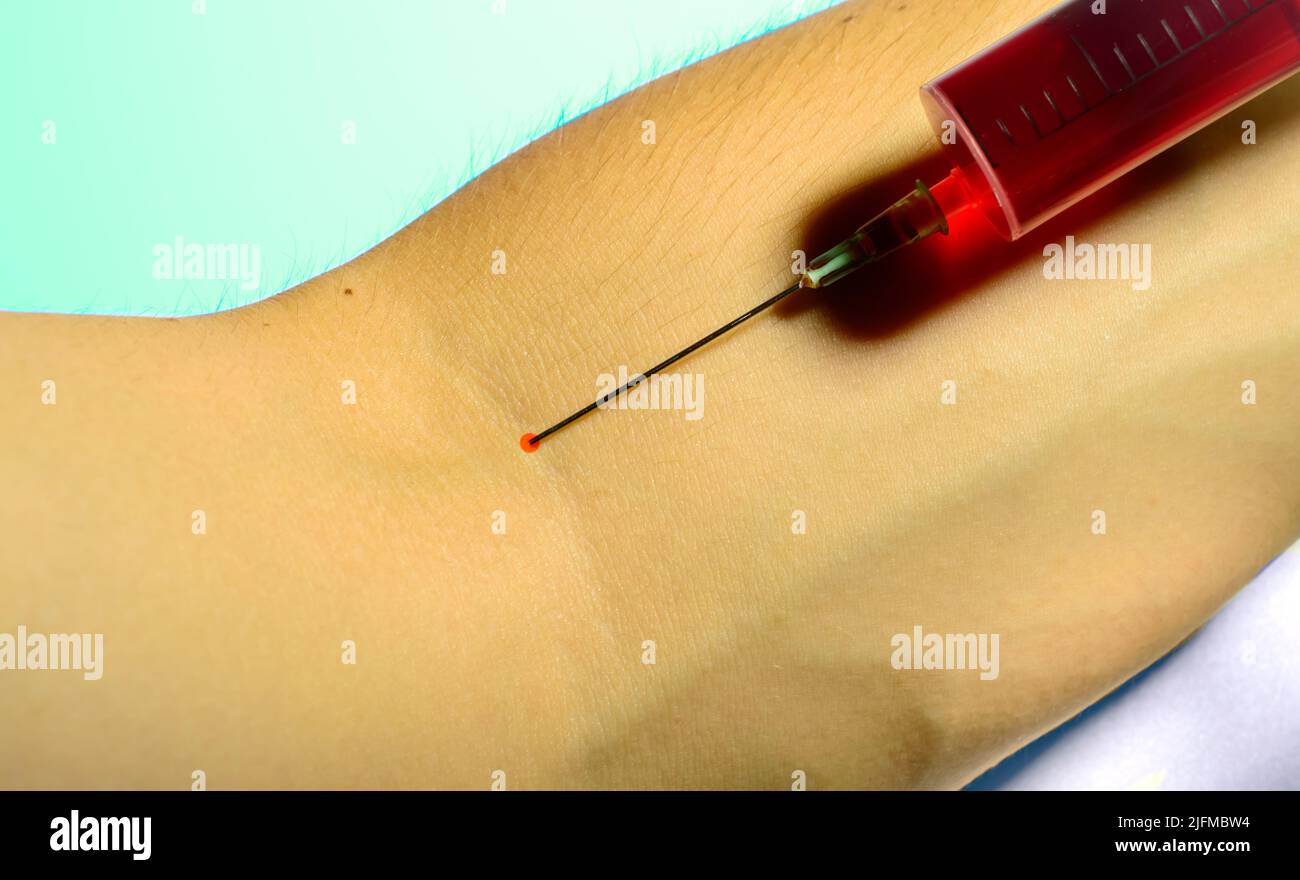 Syringe with blood. A man giving  his blood to those who need it because war in Ukraine. Social problems. Stock Photo