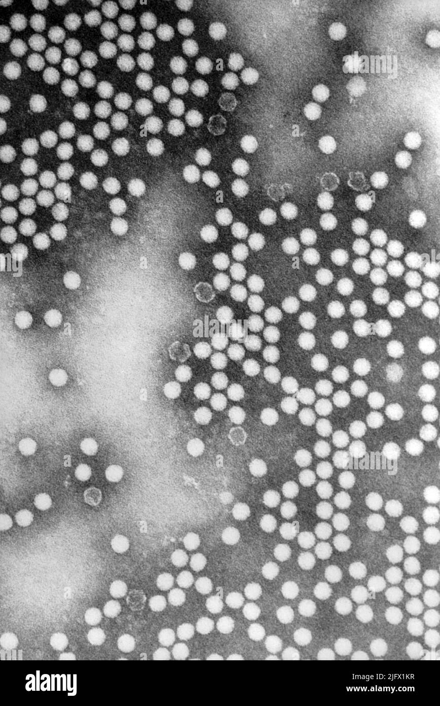 This transmission electron microscopic (TEM) image depicts numerous, round, poliovirus type-1 virions, which measured 20-30nm in diameter, and exhibited icosahedral symmetry.  An optimised and enhanced version of an image produced by the US Centers for Disease Control and Prevention / credit CDC / Dr.Joseph J. Esposito; F.A.Murphy Stock Photo