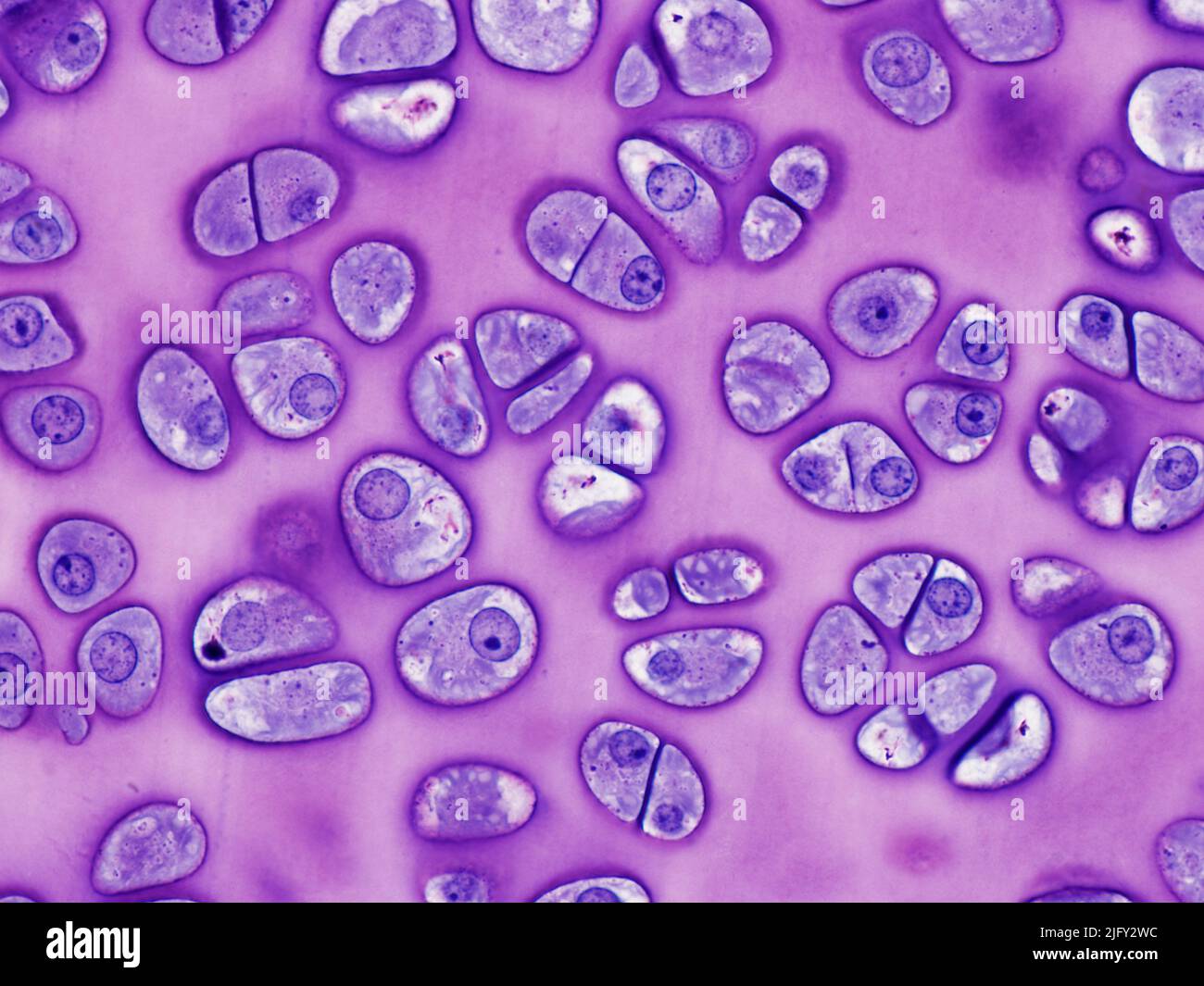 Chondrocytes, light micrograph Stock Photo - Alamy