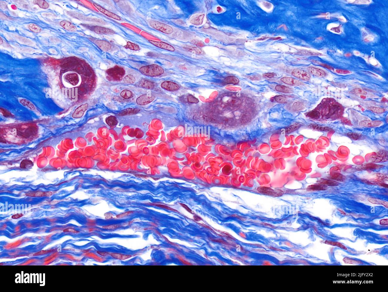 Blood vessel, light micrograph Stock Photo - Alamy