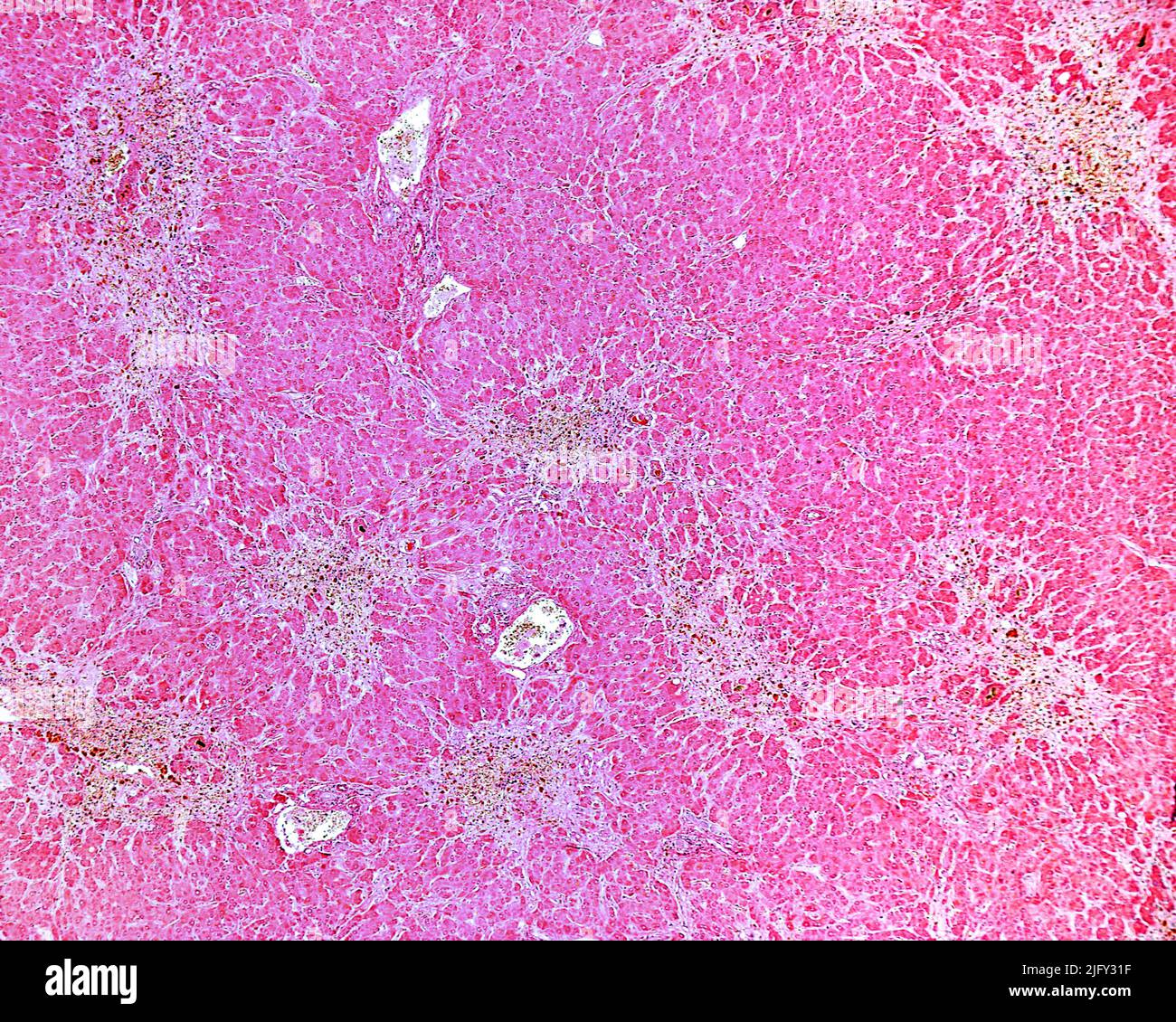is gabapentin toxic to the liver