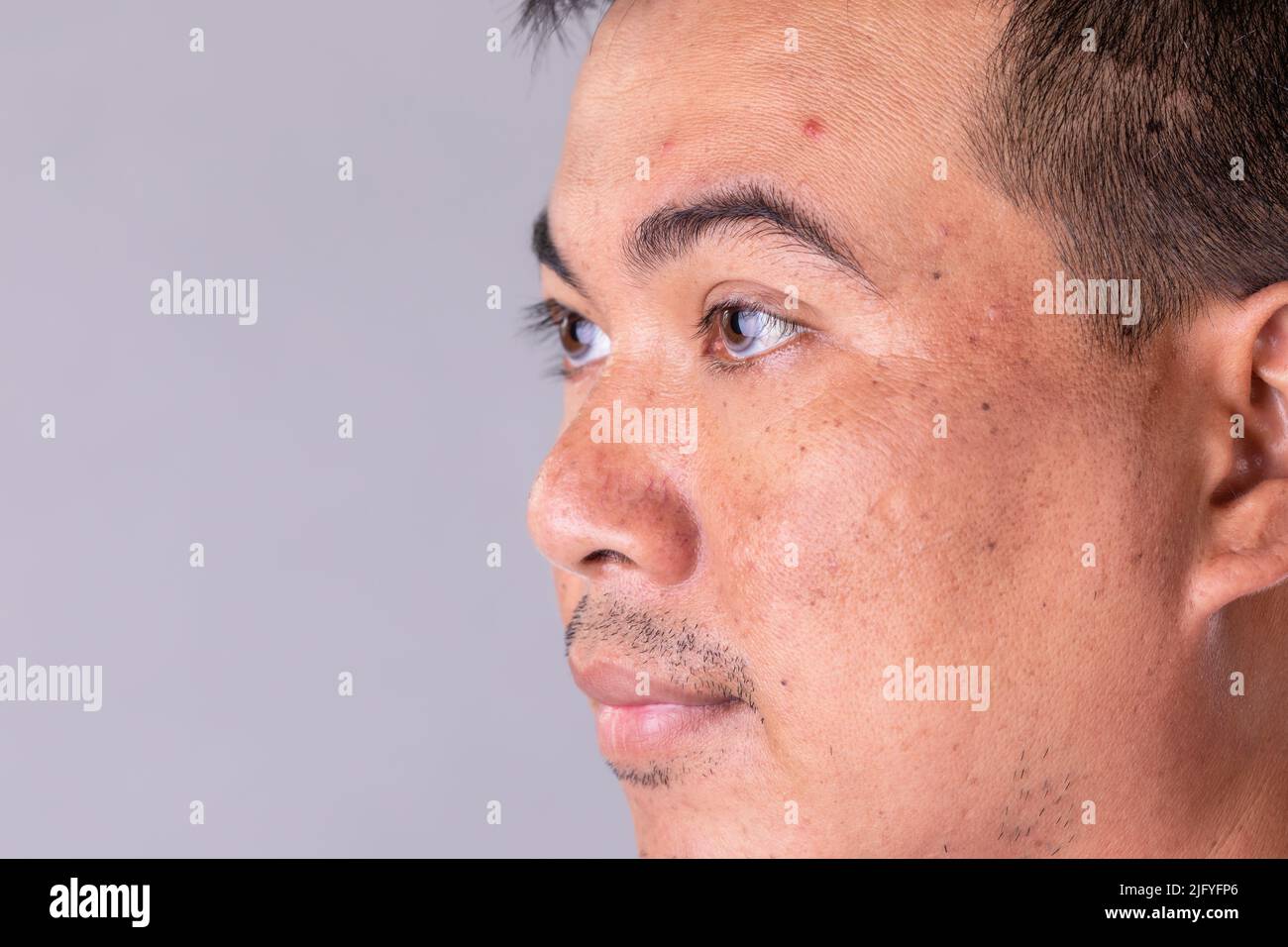 Macro face skin of asian man to show many skin problem. Men skin care concept on grey space background Stock Photo
