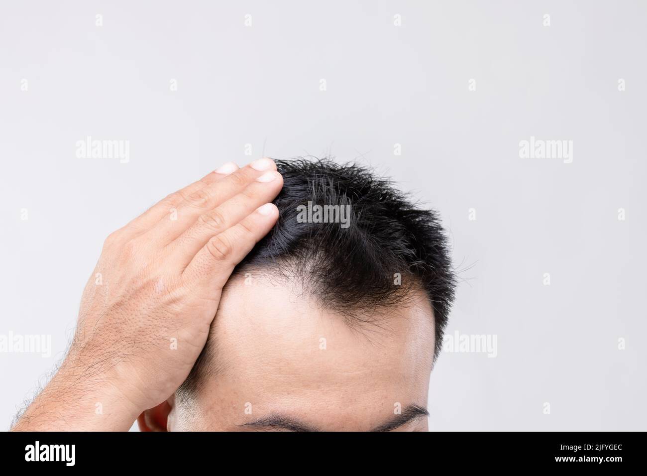Portrait Asian man with worry feeling and touching on his head to show bald head or Glabrous problem. Studio shoot with copy space with grey backgroun Stock Photo