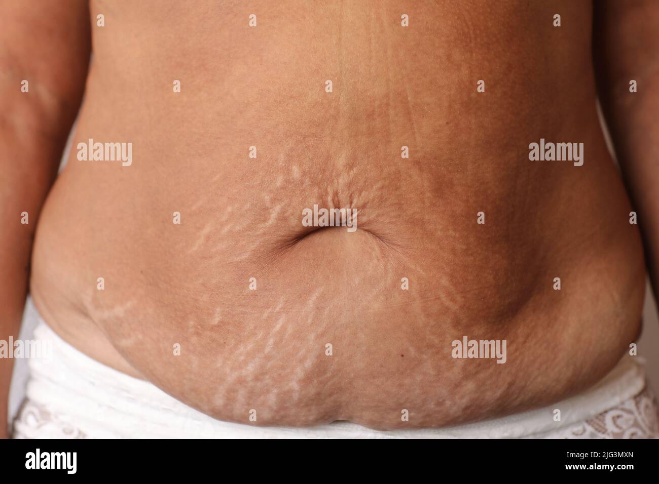 Close up of woman's belly with stretch mark loose lower abdomen skin she fat after pregnancy baby birth, studio isolated, unhealthy belly overweight e Stock Photo