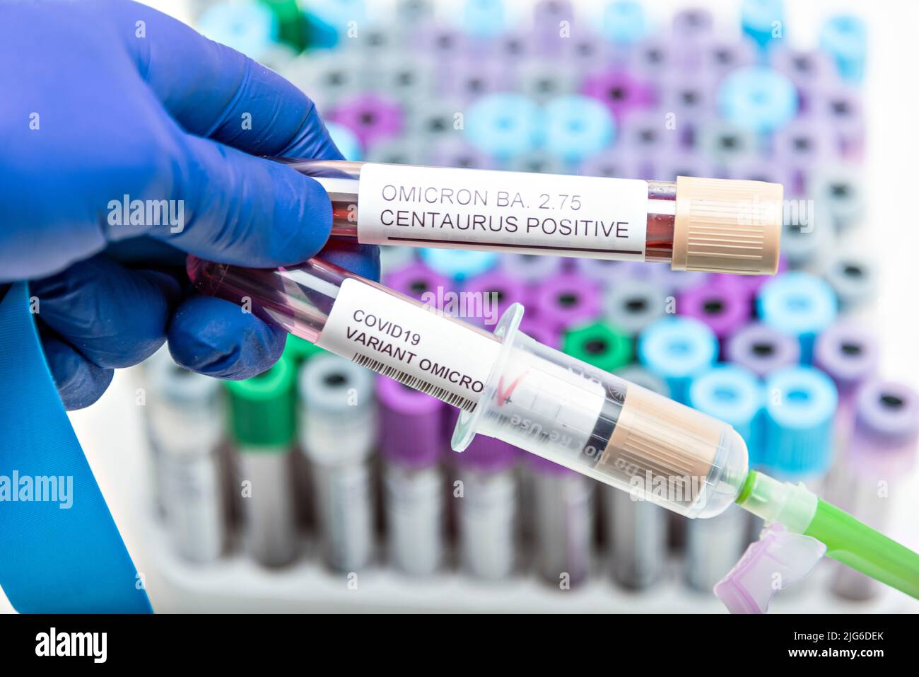 Positive blood infection sample in test tube for CENTAURUS BA 2.75
