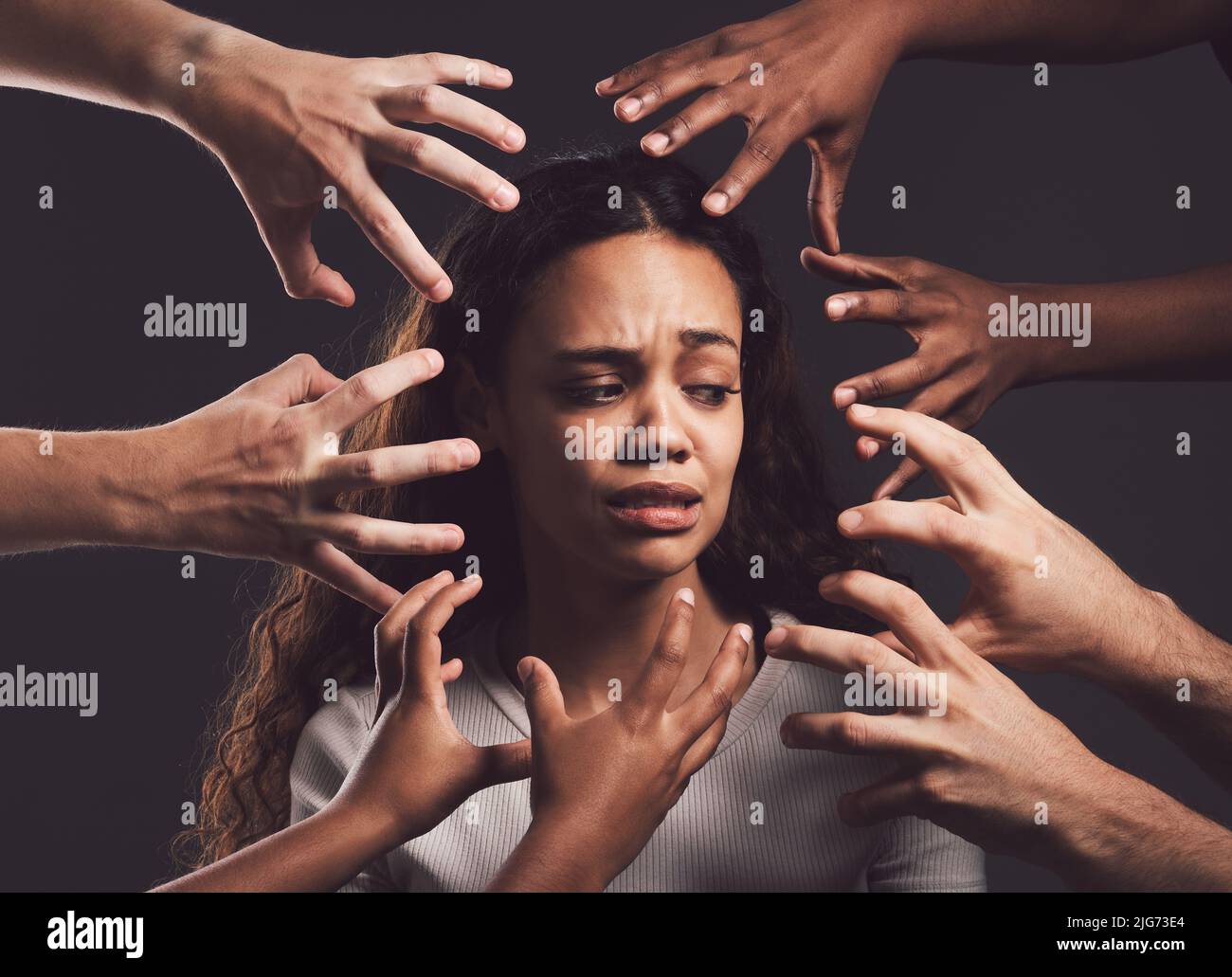 Young woman burned hires stock photography and images Alamy