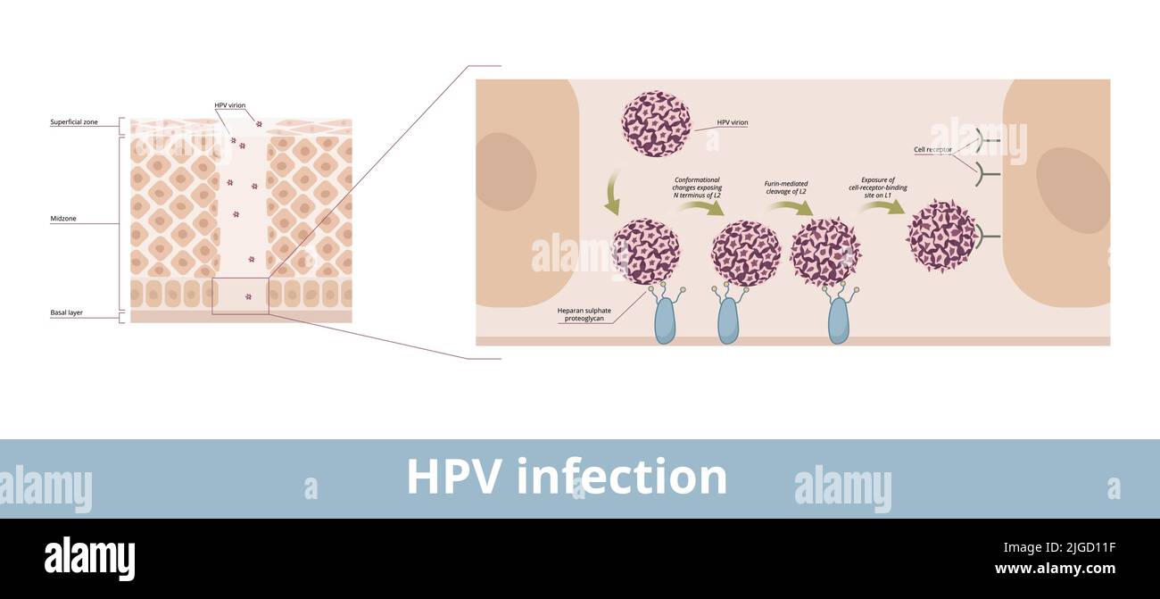 HPV infection.Process of human papillomavirus infection caused by a DNA virus with its exposing and cell receptor binding Stock Vector