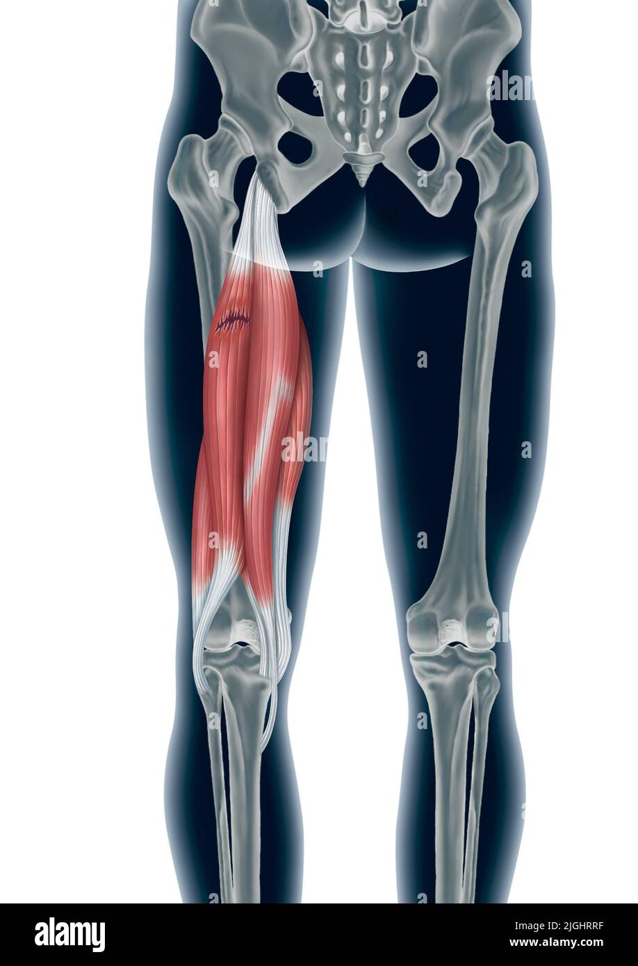 Hamstring strain Stock Photo