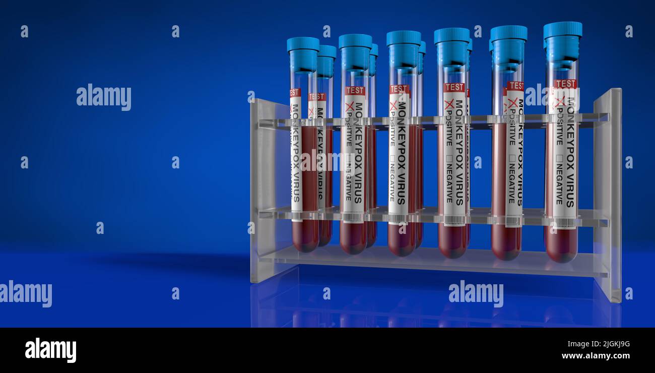 Group of test tubes in holder on reflective table with blood samples positive for monkeypox against dark blue background. 3D Illustration Stock Photo