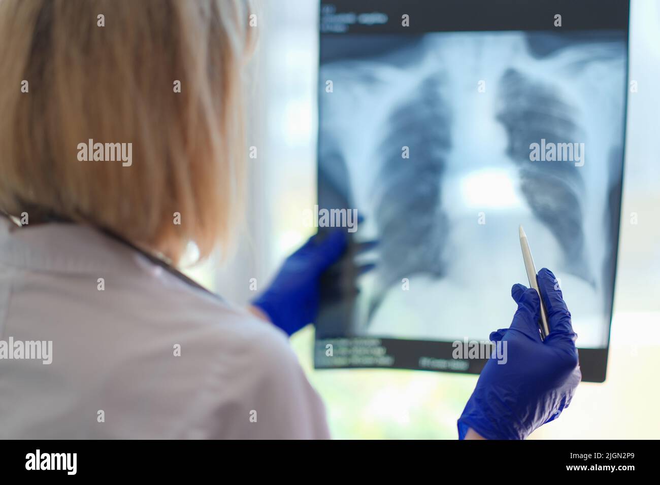 Female doctor pulmonologist holding xray photograph of lungs in hands