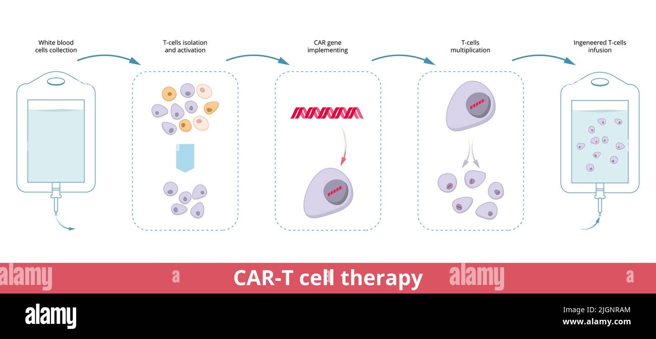 CAR-T cell therapy.Chimeric antigen receptor T cells are T cells that have been genetically engineered for use in immunotherapy Stock Vector