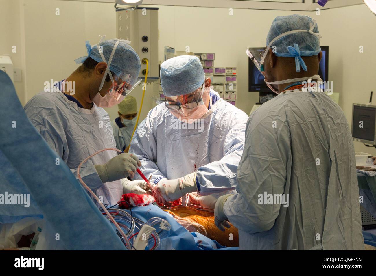 A surgeon and NHS staff perform knee surgery, also known as