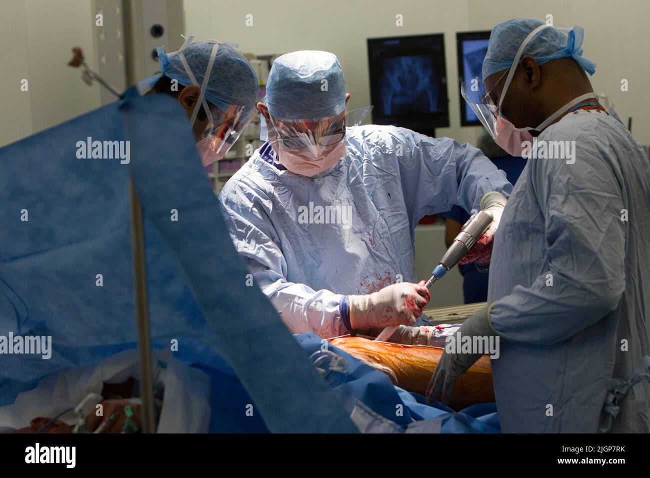 A surgeon and NHS staff perform a Hip replacement operation. A